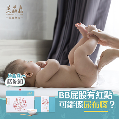 BB屁股有紅點可能係尿布疹？